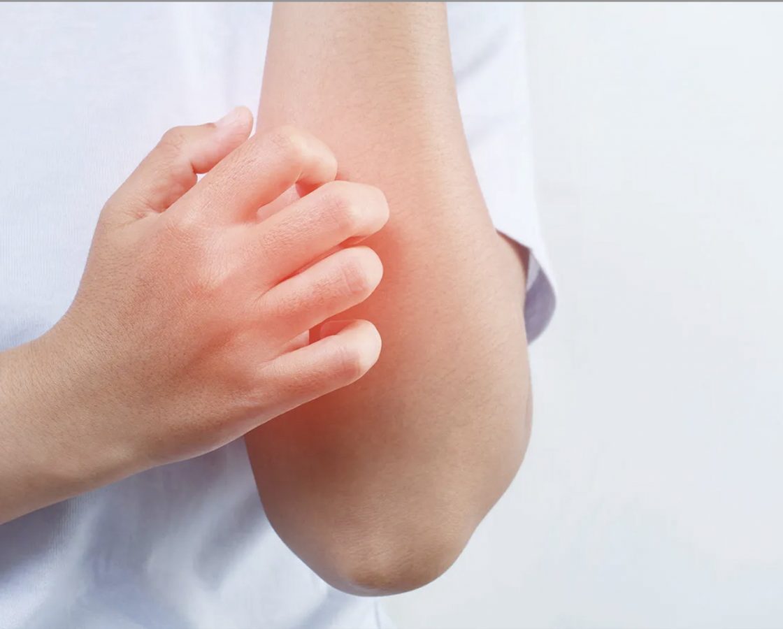 Common Communal Health Conditions – Health Services