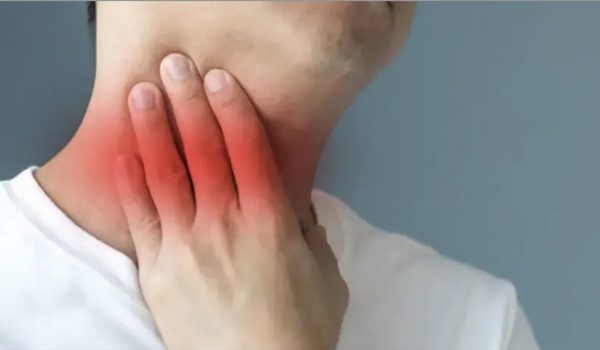 Mononucleosis