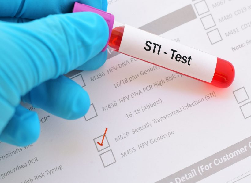 sti_test